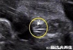 <b>B超单有这个一般是女孩，看孕囊数据/形状/大小(圆形是女宝)</b>