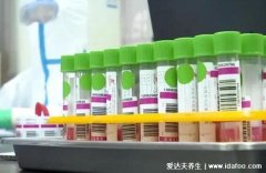 打完新冠疫苗多久可以做核酸检测，灭活疫苗至少间隔48小时